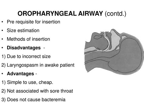 PPT - AIRWAY MANAGEMENT – establishing, maintaining & removing ...