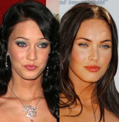 Celebrity Plastic Surgery Before And After - FunnyMadWorld