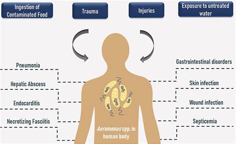 Frontiers | Aeromonas and Human Health Disorders: Clinical Approaches