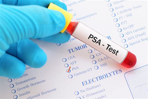 Prostate Specific Antigen - PSA - Normal PSA Level - Abnormal PSA Level