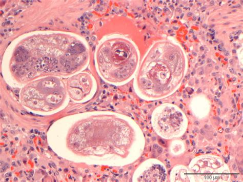 Histopathology | Cytopath