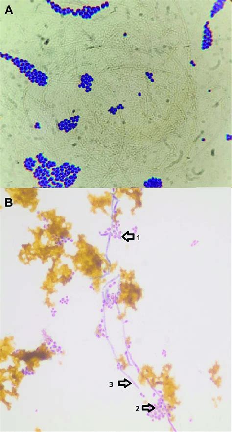 Light microscopy for histopathology smears of infected bile (400×), (A)... | Download Scientific ...