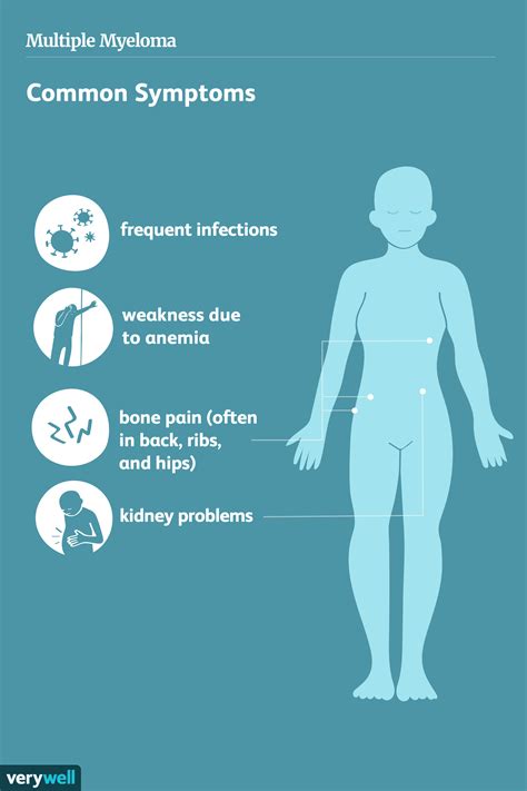 How Multiple Myeloma Is Treated