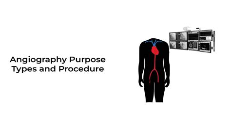 Angiography: Purpose, Types, and Procedure ~ Stat Cardiologist