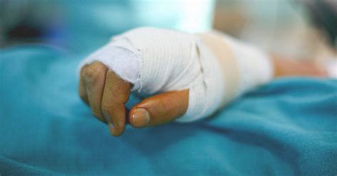 Degloving: Images, Types, Treatment, and Complications