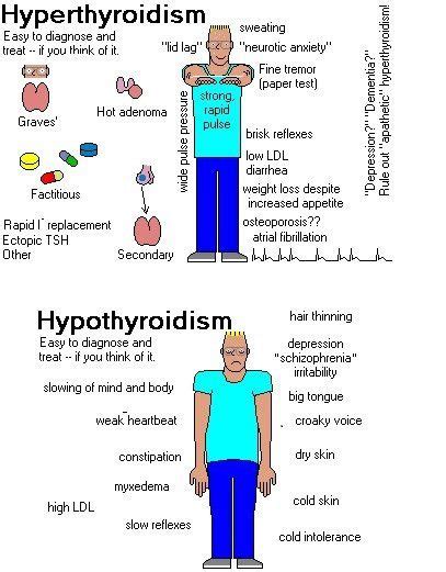 myxedema pictures - Google Search | Nursing mnemonics, Nursing school survival, Nursing school tips