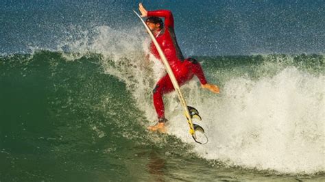 Examining most common injuries surfers suffer from | We Are Surfers