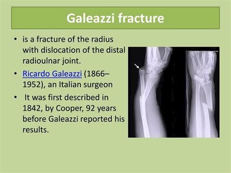 Galeazzi Fracture Classification