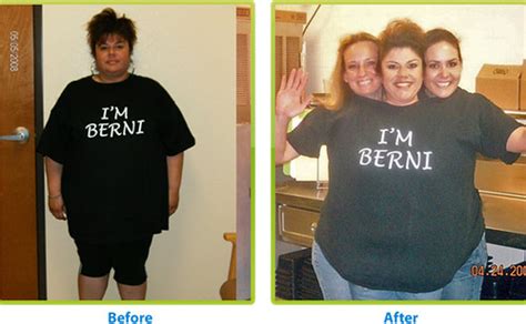 Before and after weight loss surgery | Licensed under a crea… | Flickr