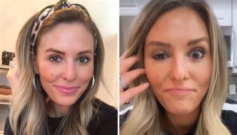 Influencer's eyelid droops after botched Botox treatment | Newshub