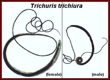 Trichuris trichiura: Morphology, life cycle, pathogeneisis, mode of transmission, diseases ...