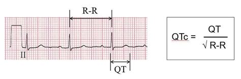 Qtc Calculator