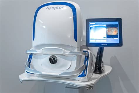 Optomap® Retinal Exams | Accent Vision Care