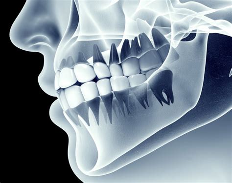 Are teeth made of bones? - News Home