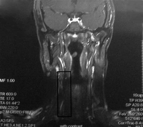 Cervical Magnetic Resonance Imaging (MRI) of the Patient with Contrast | Download Scientific Diagram