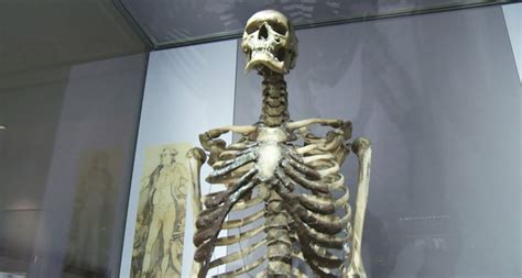 Irish giant Charles Byrne's skeleton removed from controversial display after two centuries ...