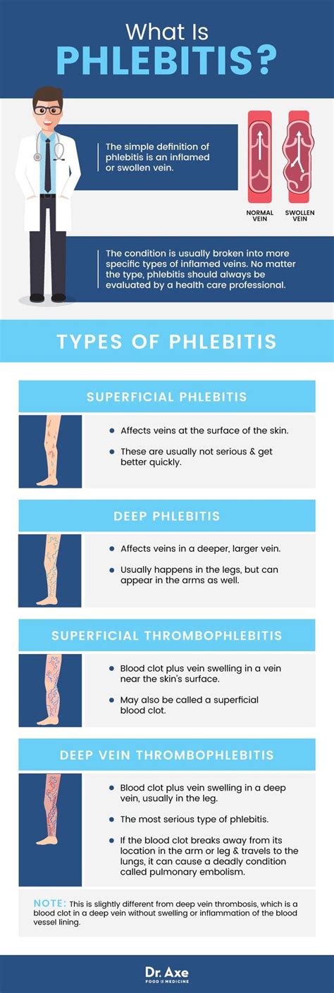 Phlebitis (5 Natural Ways to Improve Symptoms) - Dr. Axe | Phlebitis treatment, Varicose vein ...