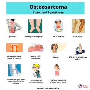 Osteosarcoma: Signs & Symptoms