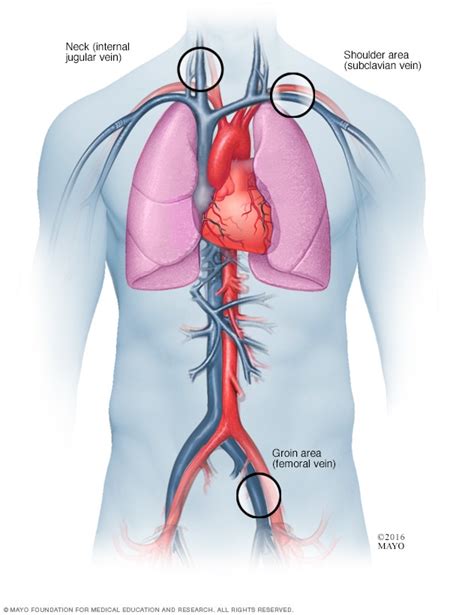 St. Elizabeth Healthcare - Procedure