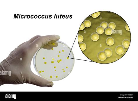 Micrococcus luteus hi-res stock photography and images - Alamy