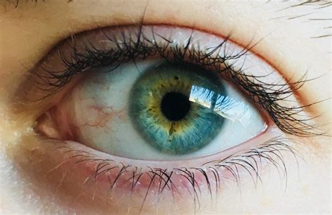 My blueish greenish yellowish eye :) : r/eyes