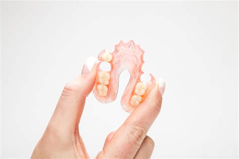 What Are Flexible Partial Dentures? - TORRENS DENTAL CARE