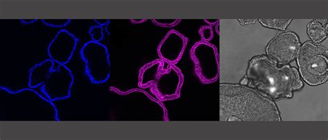 Location, location, location – even gut immune response is site-specific