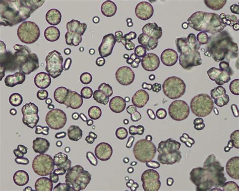 Leucine Crystals