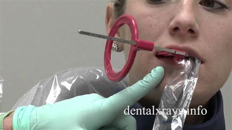 Premolar bitewing positioning tips for dental x-rays | Dental Assisting | Dental hygienist ...