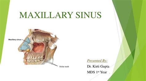 Maxillary Sinus