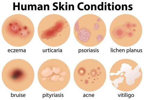 A Set of Human Skin Conditions 300507 Vector Art at Vecteezy