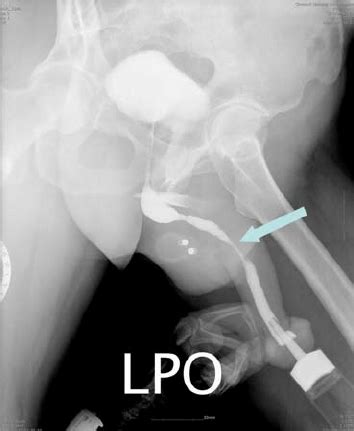 Urethrogram Anatomy