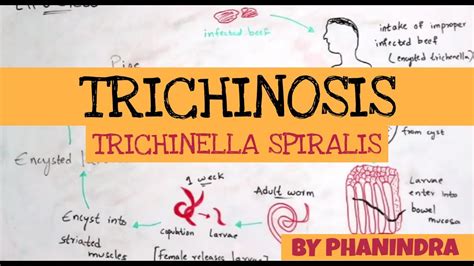 TRICHINOSIS || TRICHINELLA SPIRALIS || STRUCTURE || LIFE CYCLE ...