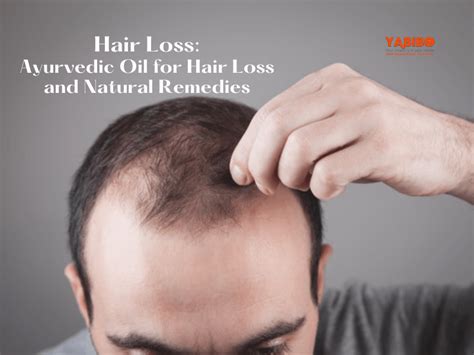 Hair Loss: Ayurvedic Oil for Hair Loss and Natural Remedies