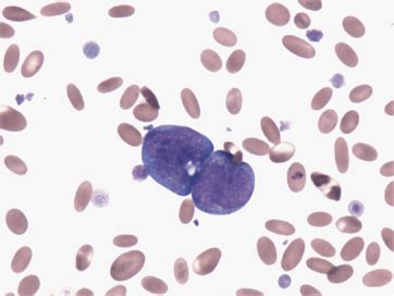 Peripheral blood from an alpaca showing large blast cells containing... | Download Scientific ...