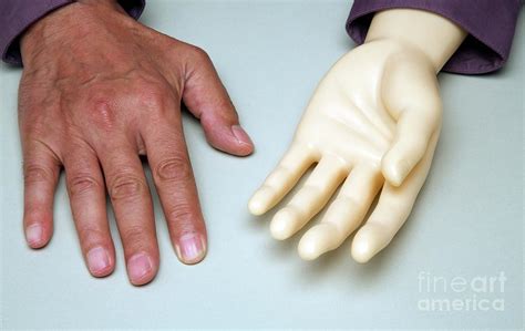 Artificial Hand And Human Hand Photograph by Victor De Schwanberg ...