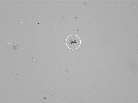 Image Quiz: Whats up with this urine sample?