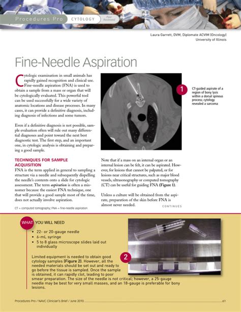 Fine-Needle Aspiration