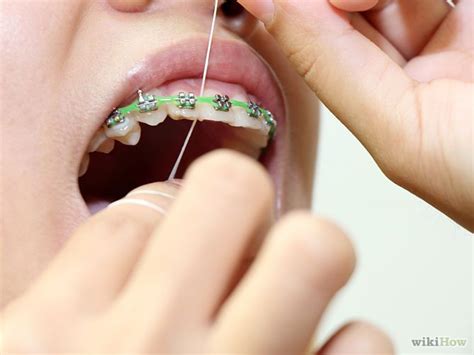 How to Floss With Braces | Dental flossing, Flossing, Braces dos and donts