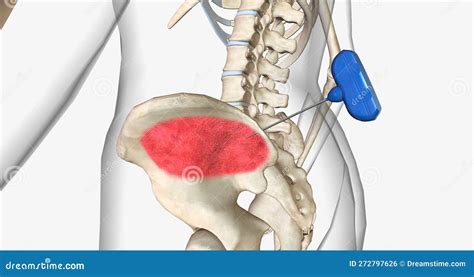 Bone Marrow Biopsy, External View Stock Photo | CartoonDealer.com #272797626