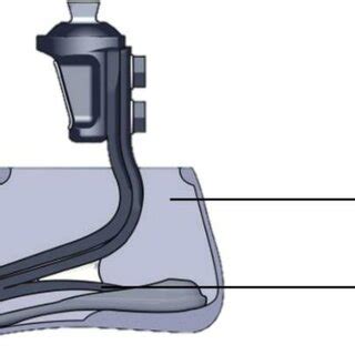 5 Representation of (a) the prosthetic foot setup, the exploded views ...