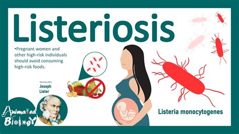 Listeriosis (Listeria Monocytogenes) | Sources, Pathophysiology ...