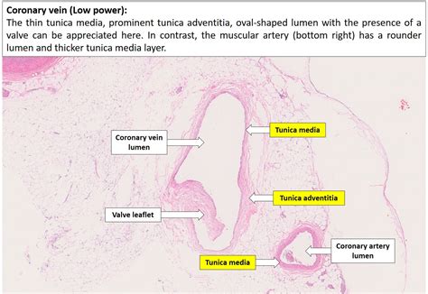 Arteries And Veins Histology