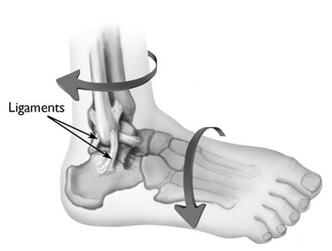 Sprains, Strains and Other Soft-Tissue Injuries - OrthoInfo - AAOS