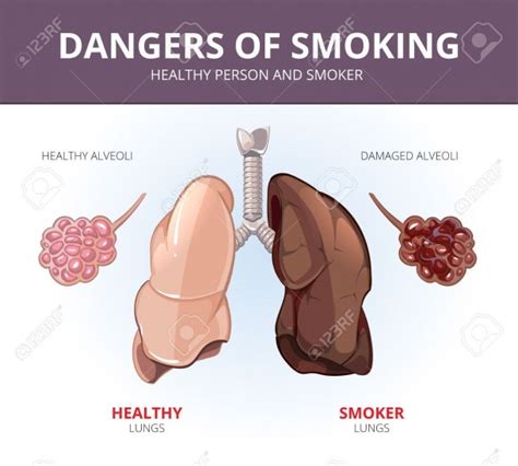 Diagram Of A Smokers Lungs