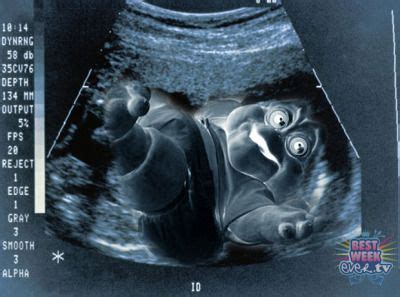 Funny Baby Ultrasound