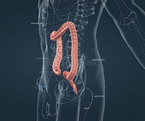 Appendicitis is a Painful Swelling of the Appendix Stock Illustration - Illustration of medicine ...