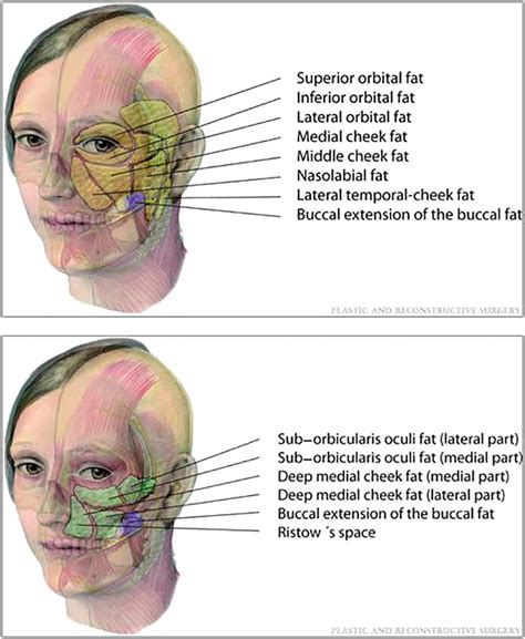 Schematic of the superficial and deep fat compartments. The superficial ...