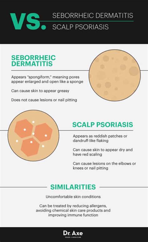 Seborrheic Dermatitis Causes + 7 Natural Treatments - Dr. Axe