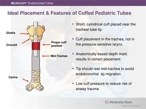 PPT - M ICROCUFF * Pediatric Endotracheal Tubes PowerPoint Presentation - ID:408679